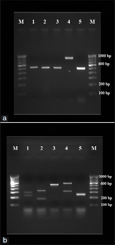 (a) PCR products from standard strains of Candida species. Lanes 1-5: C. albicans (ATCC 90028), C. tropicalis (ATCC 750), C. parapsilosis (90018), C. glabrata (pure strain from NCCPF) and C. krusei (6258), respectively. Lanes M: 100 bp DNA ladder. (b) RFLP products from standard strains of Candida species. Lanes 1-5: C. albicans (ATCC 90028), C. tropicalis (ATCC 750), C. parapsilosis (90018), C. glabrata (pure strain from NCCPF) and C. krusei (6258), respectively. Lanes M: 100 bp DNA ladder.