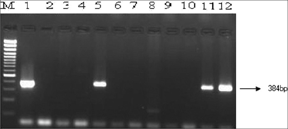 Direct detection of eaeA gene of enteropathogenic and enterohemorrhagic E. coli in stool samples by PCR. Lane M, 100 bp DNA ladder (Genetix); Lane 1, Reference strain EDL 933; Lane 2, Negative control strain; Lanes 3-12, Stool 91 to Stool 100; Lanes 5, 11 and 12, Stool samples positive for eae genes