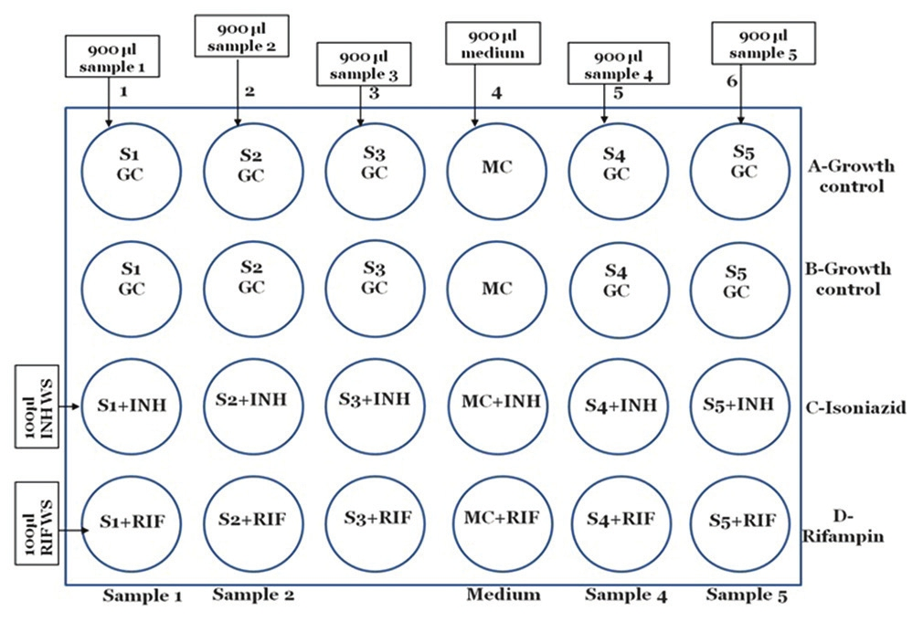 Setting up of microscopic observation drug susceptibility assay plate for sample/culture