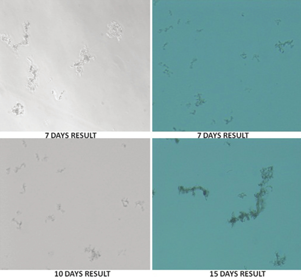 Demonstration of microscopic observation drug susceptibility assay results on different days of incubation, under different light settings. 7 days: Growth of mycobacterial cords on day 7, 10 days: Growth of mycobacterial cords on day 10. 15 days: Growth of mycobacterial cords on day 15