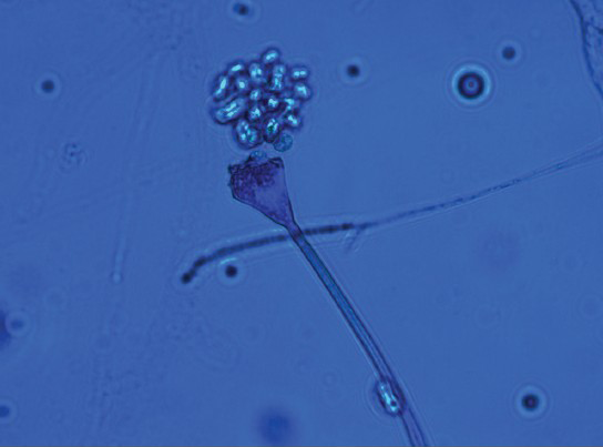 Lactophenol Cotton Blue mount of slide culture showing funnel shaped sporangia and sporangiospores of Apophysomyces elegans