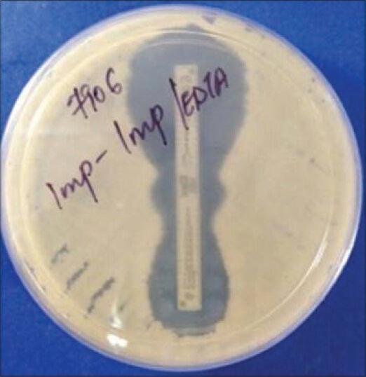 Phantom zone in E-test indicating carbapenemase production