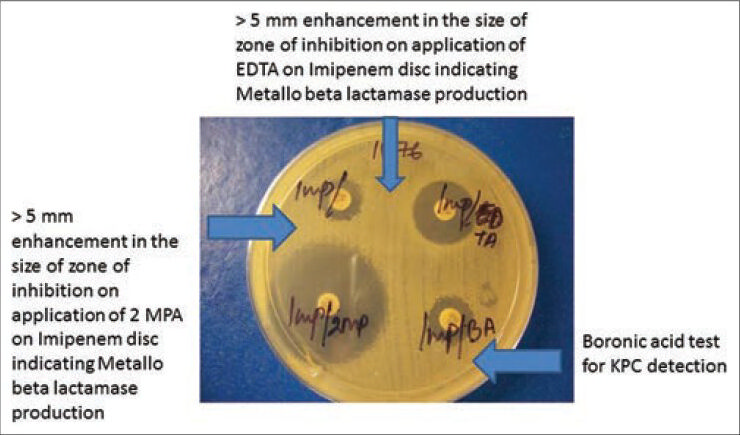 Different methods of detection of metallo-beta-lactamase and Klebsiella pneumoniae carbapenemases