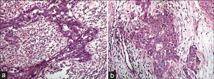Photomicrographs showing adequacy and clarity of nuclear and cytoplasmic staining. (a) Conventional (H and E, ×200), (b) Xylenealcohol free (H and E, ×200)