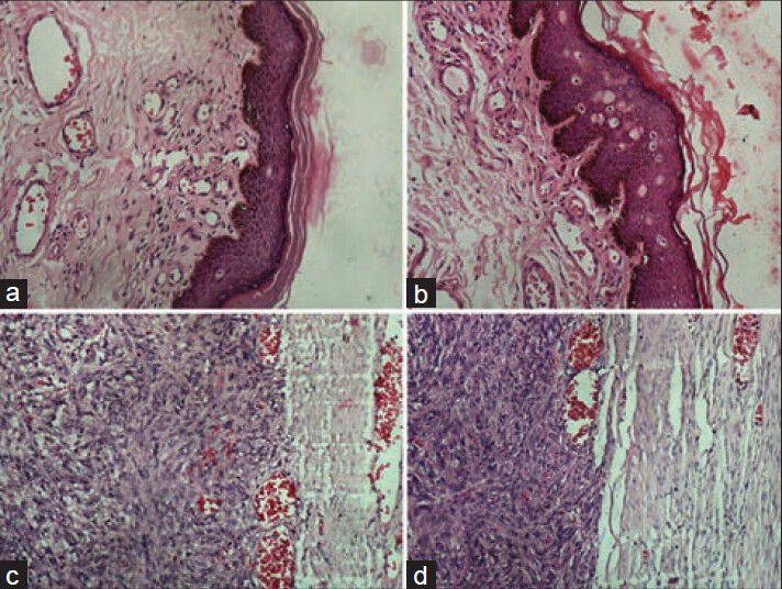 Photomicrographs showing crispness of staining in epithelial and connective tissues. (a) Epithelial tissue stained with conventional (H and E, ×200), (b) Epithelial tissue stained with xylene-alcohol free (XAF) (H and E, ×200), (c) Connective tissue stained with conventional (H and E, ×200), (b) Connective tissue stained with XAF (H and E, ×200)