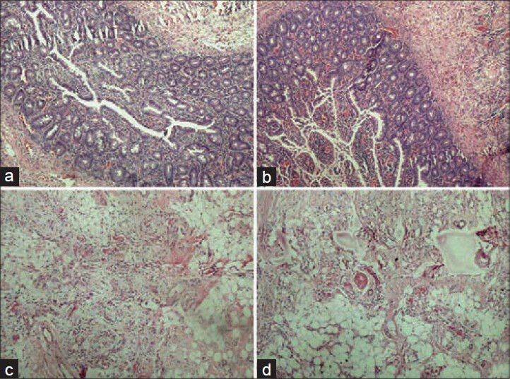 Photomicrographs showing crisp staining in glandular tissue and adipose tissue, (a) Glandular tissue with conventional (H and E, ×100), (b) Glandular tissue with xylene-alcohol free (XAF) (H and E, ×100), (c) Adipose tissue with conventional (H and E, ×100), (b) Adipose tissue with XAF (H and E, ×100)
