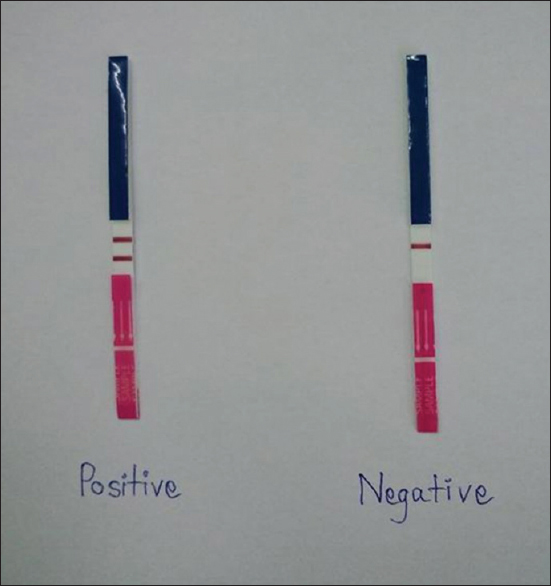 Immunochromatograph (IC) of IC strip (GPO α THAL IC strip test, Thailand) for α-thalassemia screening carriers. The left strip and right strip were presented two bands and one band of ICs, which were interpreted as positive and negative for alpha-thalassemia-1 carriers, respectively
