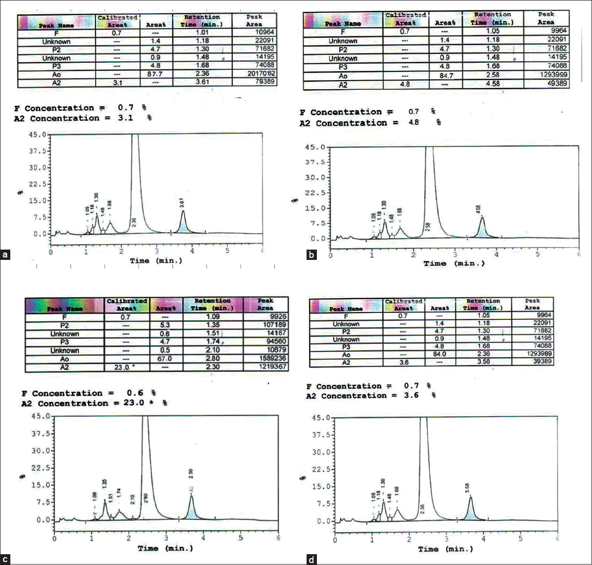 Chromatogram of hemoglobin (Hb) typing by high-performance liquid chromatography. The results read as follows: (a) A2A; (b) A2A (increased A2 than normal); (c) EA; (d) EE, which were interpreted as normal, beta-thalassemia trait, heterozygous HbE, and homozygous HbE, respectively