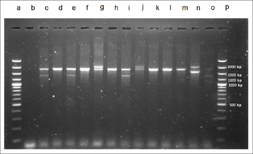 DNA electrophoresis separation of polymerase chain reaction (PCR) products from multiplex PCR. (1) Lane a and p were DNA ladder. (2) Lane d, f, h, k, l, and m were interpreted to normal globin gene (1,800 bp). (3) Lane c, e, i, and o were interpreted to South East Asian type. (4) Lane g and j were interpreted to 3.7 kb deletion type (2,022 bp). (5) Lane n (control) was 4.2 kb deletion type. Except DNA ladder, all lanes must be 1 band to 2 bands because alpha globin cluster had only 2 alleles