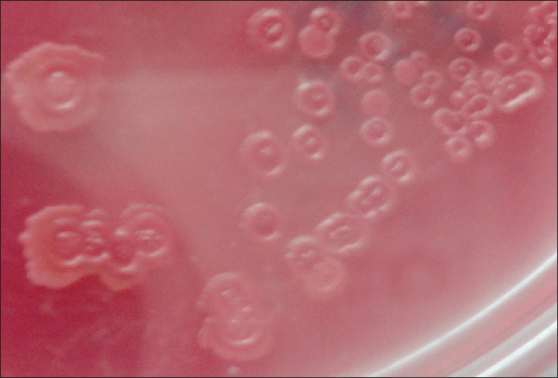 MacConckey's agar showing dry and wrinkled colonies