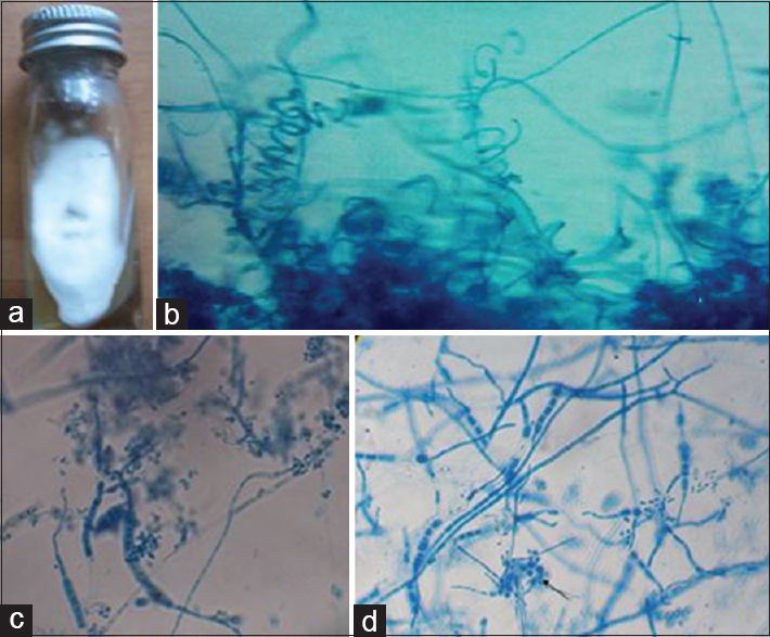 Trichophyton mentagrophytes. (a) Growth on Sabouraud's dextrose agar. (b) Lacto phenol cotton blue mount showing spiral hyphae (×400). (c) Lacto phenol cotton blue mount showing macroconidia (×400). (d) Lacto phenol cotton blue mount showing Nodular organ (×400)
