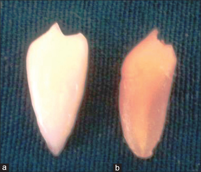 Discoloration: Yellow color change in the tooth after decalcification (b) with nitric acid in comparison with the tooth before decalcification (a)