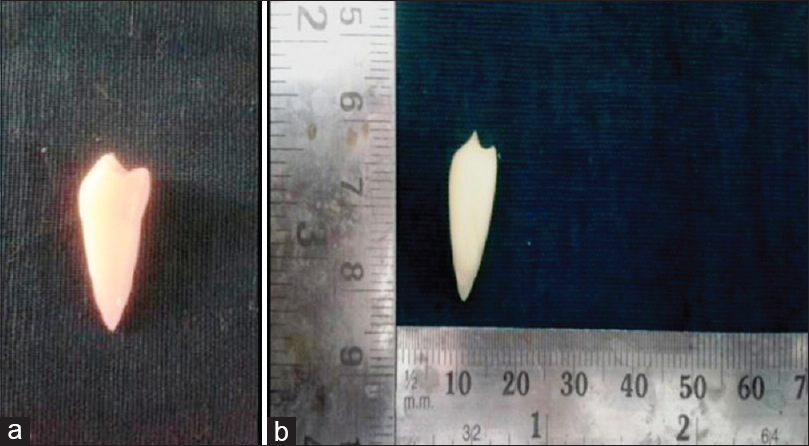 Comparison of tearing and shrinkage of tooth before (a) and after (b) decalcification with formic acid