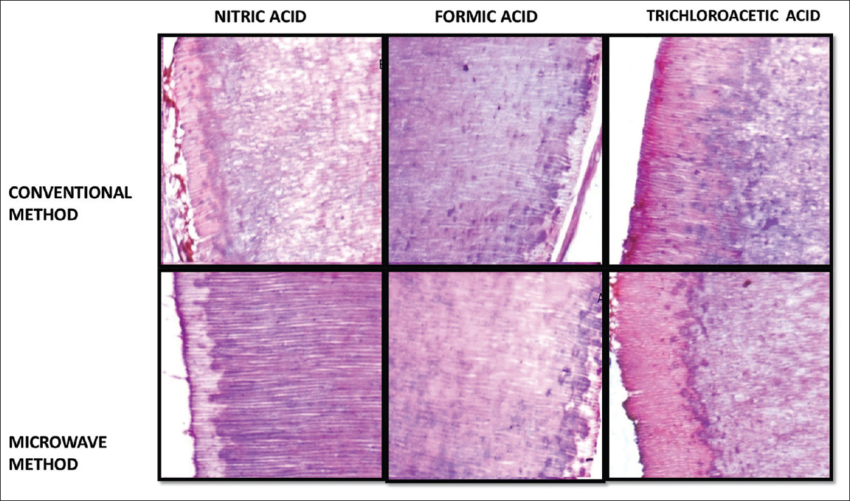 H and E, section revealing staining characteristics and structural details for 5% nitric acid, formic acid, and trichloroacetic acid using conventional and microwave method (×100)