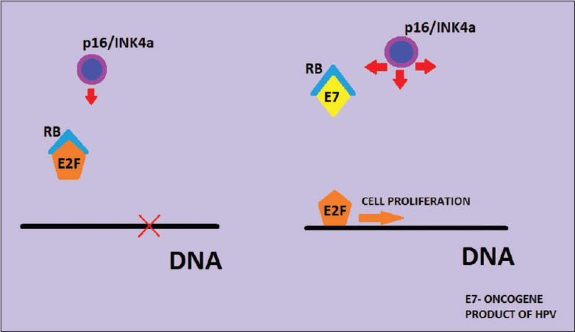 Mechanism of p16/INK4a overexpression in cervical human papillomavirus infection