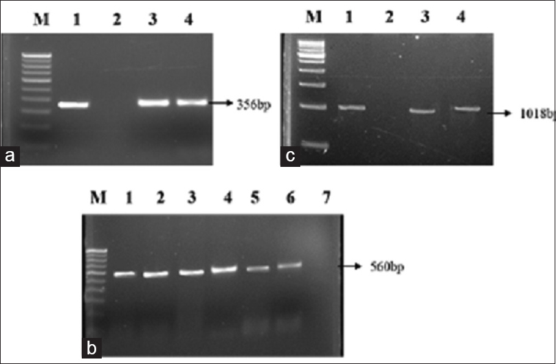 (a) Polymerase chain reaction amplification picture of cefotaximase gene in extended-spectrum beta lactamase producing Escherichia coli strains after agarose (1.5%) gel electrophoresis. Lane M: Molecular marker 100 bp DNA ladder; lane 1: Positive control; lane 2: Negative control; lane 3 and 4: Escherichia coli clinical isolates. (b) Polymerase chain reaction amplification of temoneira gene. Lane M: 100 bp DNA ladder; lane 1: Positive control; lane 2–6: Escherichia coli clinical isolate; lane 7: Negative control. (c) Polymerase chain reaction amplification of sulfhydryl variable gene. Lane M: 500 bp DNA ladder; lane 1: Positive control; lane 2: Negative control; lane 3 and 4: Escherichia coli clinical isolates