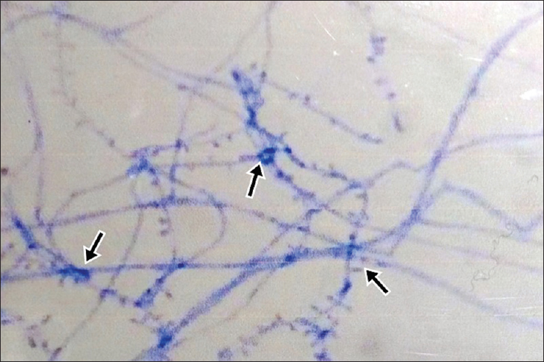 LCB with with hyphae lined with microconidia (×40)