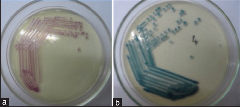 Growth of carbapenem resistant Enterobacteriaceae on the HiCrome KPC Agar: (a) Pink to magenta colored colonies produced by Escherichia coli and Citrobacter freundii, (b) Bluish-green colored colonies produced by Klebsiella, Enterobacteri, and Serratia species