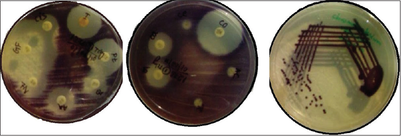Pigmented colonies of Chromobacterium violaceum on Nutrient agar and antimicrobial susceptibility testing