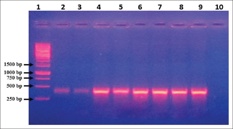 Agarose gel electrophoresis of DNA amplified using conventional wet-reagent mix polymerase chain reaction with rpoB gene primers. Lane 1: Molecular size marker (1 kb Ladder), Lane 2–3: Extracted DNA of Acinetobacter baumannii (ATCC) used as template, Lane 4–9: Extracted DNA from different clinical isolates of Acinetobacter used as template, Lane 10: Blank