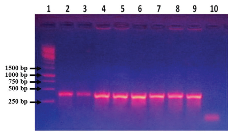 Agarose gel electrophoresis of polymerase chain reaction products obtained from Acinetobacter using dry-reagent mix polymerase chain reaction with rpoB primers. Lane 1: Molecular size marker (1 kb Ladder), Lane 2–3: Extracted DNA of Acinetobacter baumannii (ATCC) used as template, Lane 4–5: Acinetobacter baumannii (ATCC) overnight grown culture as template, Lane 6–7: DNA extracted from clinical isolate of Acinetobacter as template, Lane 8–9: Overnight grown culture of Acinetobacter clinical isolate as template, Lane 10: Blank