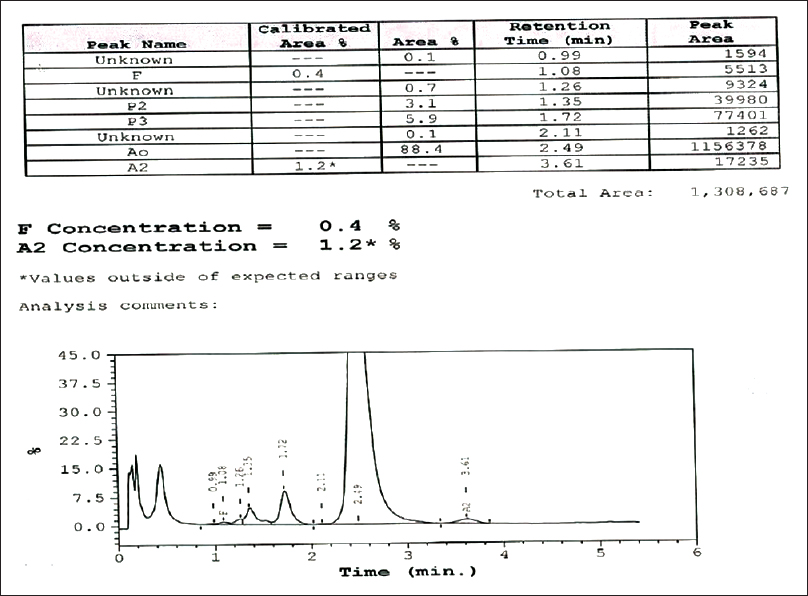 Cation exchange high-performance liquid chromatography chromatogram of the patient's blood sample showing hemoglobin H beside the normal hemoglobin (hemoglobin A2 and hemoglobin F)