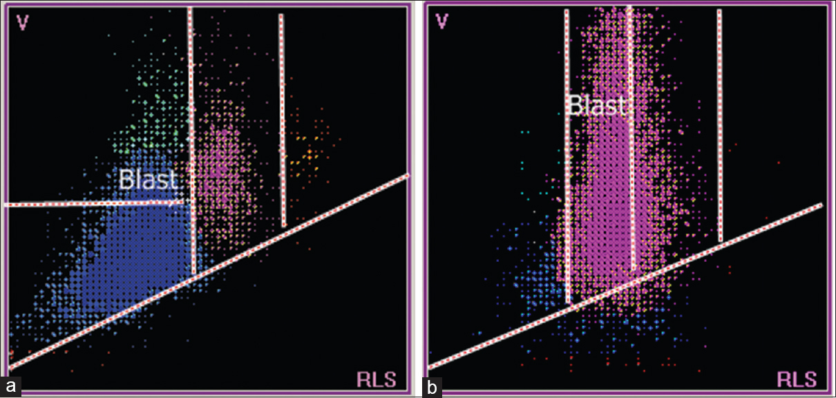 Scattergrams from a patient with acute lymphoblastic leukemia (a) and a patient with acute myeloid leukemia (b). (a) Lymphocytes in the lymphoblast region which is well above normal lymphocyte population. (b) Neutrophils in the myeloblast region which is well above normal neutrophil population