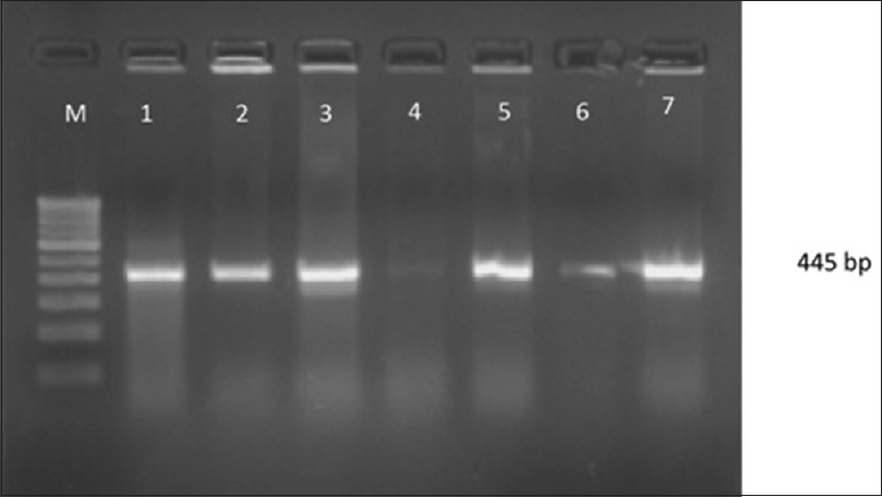 Gel Doc picture showing polymerase chain reaction amplified product of blaCTX-M-1. Lane M- marker (100bp DNA ladder), Lane-1-7- positive amplicons of clinical isolates of Klebsiella pneumoniae with blaCTX-M-1 (445 bp)