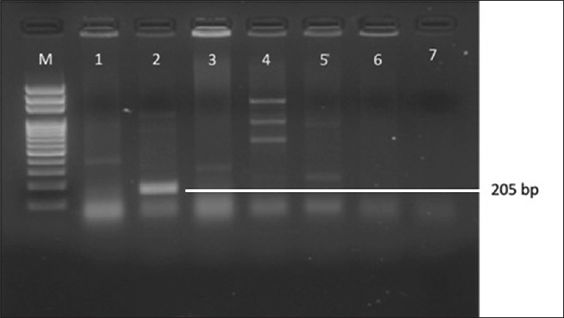 Gel Doc picture showing CTX-M - 9 polymerase chain reaction product on a 2% Agarose gel. M- marker (100bp DNA ladder), Lane 2 and 5 - bla CTX-M-9 positive amplicons (205 bp)
