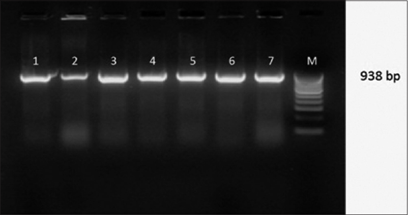 Gel Doc picture showing CTX-M -15 Uniplex polymerase chain reaction products on a 2% Agarose gel. Lane 1,2,3,4,5,6,7- clinical isolates showing bla CTX-M-15 positive amplicons (938bp), M- marker (100bp DNA ladder)