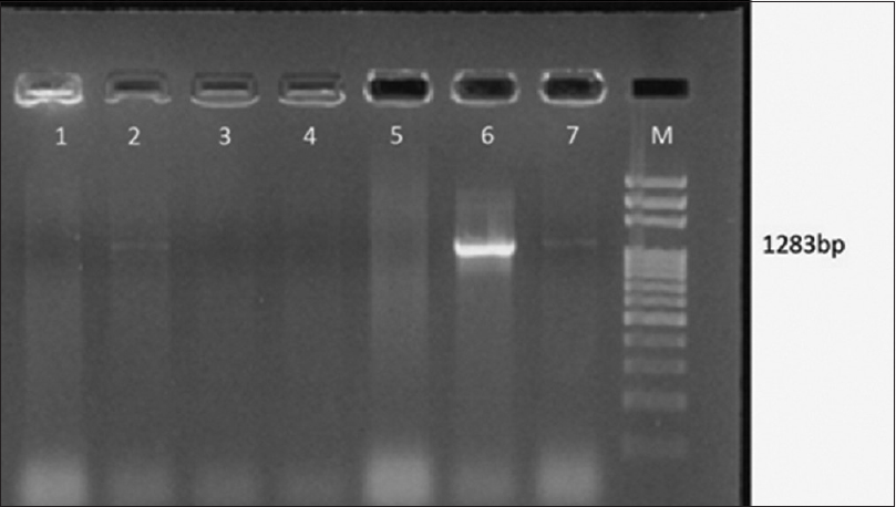 Gel Doc picture showing polymerase chain reaction amplified product of genes for K1 antigen. Lane M – 1 Kb DNA ladder, Lane 2, 6, 7 positive amplicon genes for K1 antigen (1283 bp) of isolates of Klebsiella pneumoniae