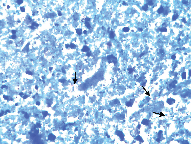 Microphotograph showing the presence of acid–fast bacilli (arrows) (ZN, ×100)