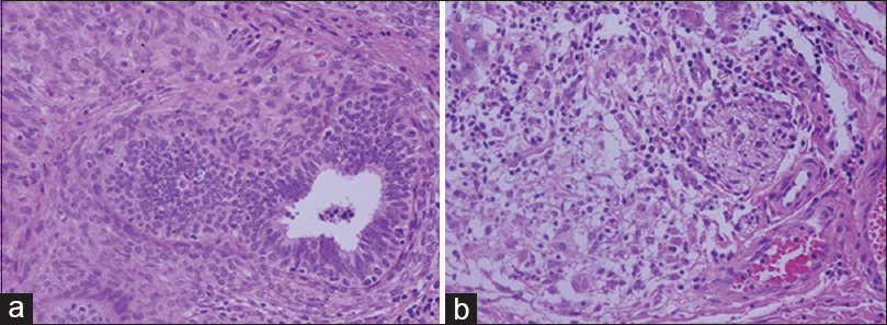 Hematoxylin and eosin stain of testis at magnification ×40. (a) UltraClear™ processed, (b) Xylene processed
