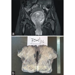 Article figure