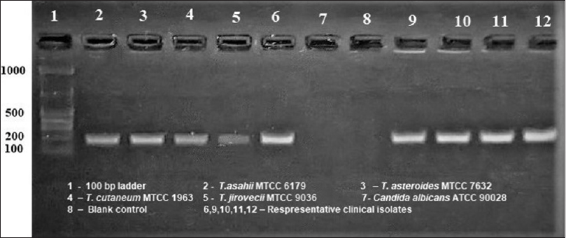 Trichosporon specific polymerase chain reaction