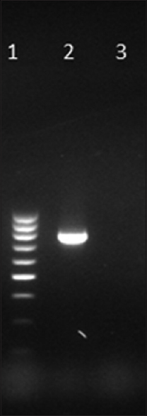 Gel picture of amplified KPC gene. Lane 1: 100 bp DNA ladder, Lane 2: Test positive for blaKPC at 798 bp, Lane 3: Negative control