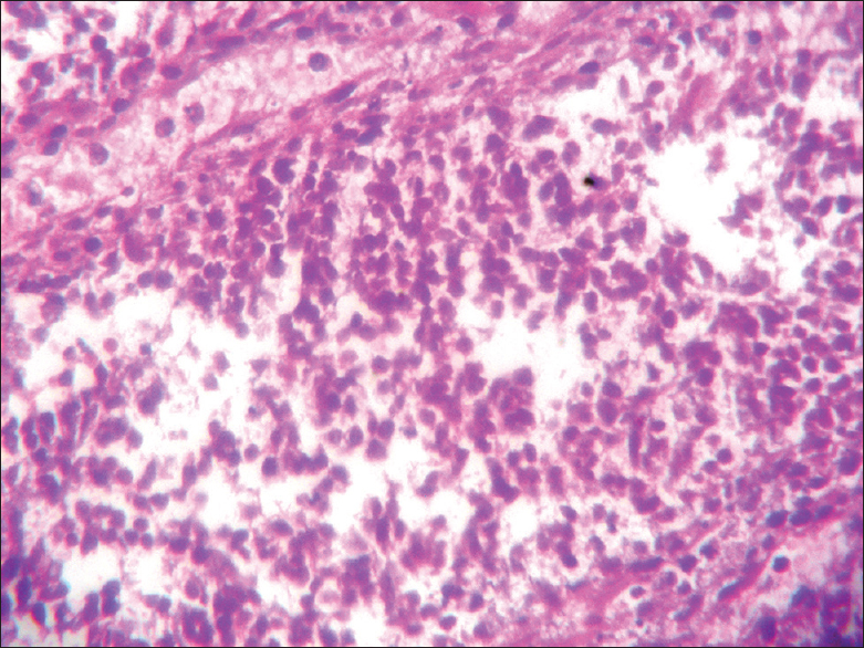 Histology of blastemal cells (×400)