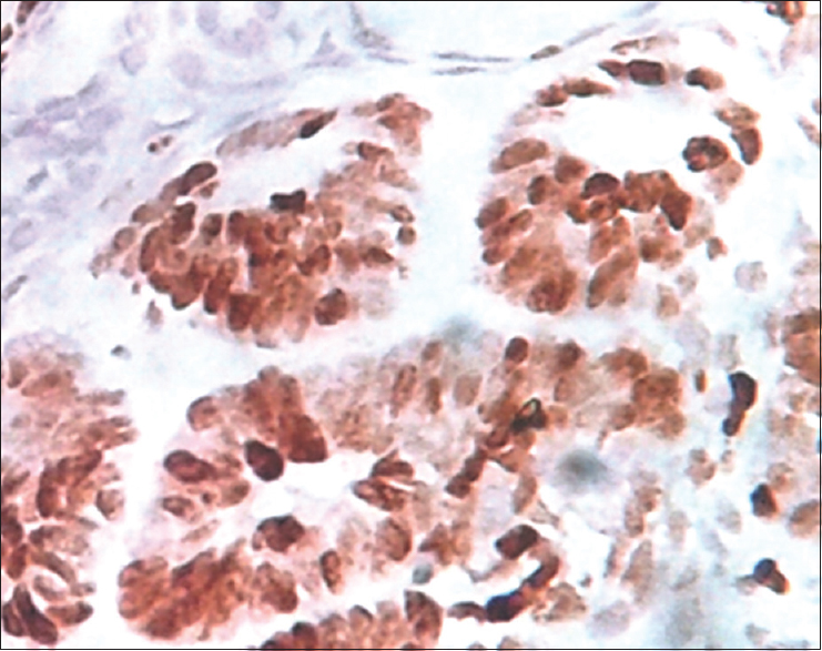 Ki67-positive cells in epithelial cells (×400)