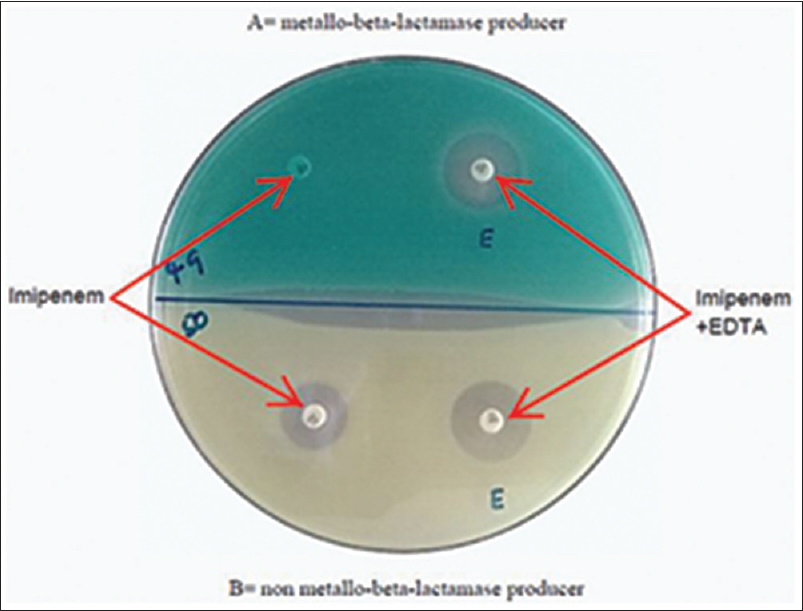 Photo of a Combined Disc Test showing strain A as metallo-beta-lactamase producer and strain B as non metallo-beta-lactamase producer