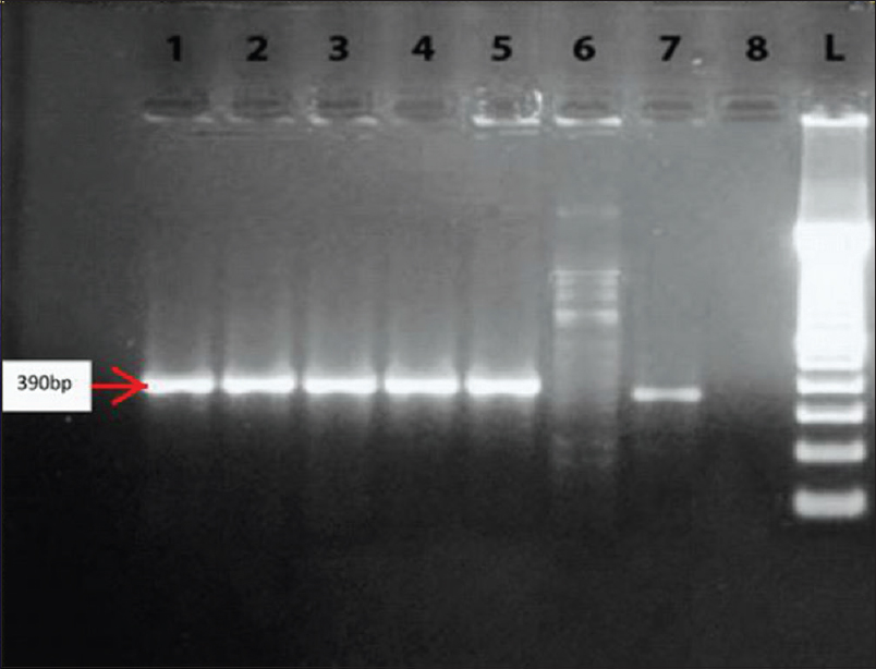 Polymerase chain reaction products after agarose gel electrophoresis. Lanes 1-5 and 7 show one band with molecular size 390 bp (VIM gene), lane 6 is a VIM negative strain, and lane 8 is water (negative control). Lane L contains a 100 bp ladder