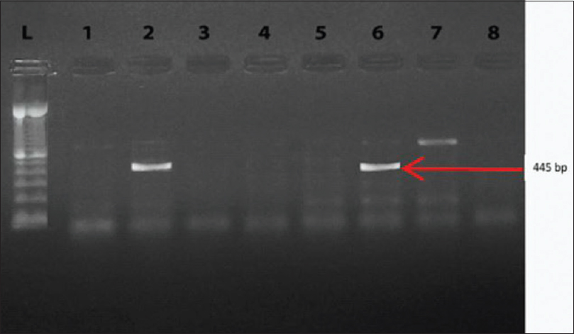 Polymerase chain reaction products after agarose gel electrophoresis. Lanes 2 and 6 show one band with molecular size 445 bp (NDM-1 gene, lanes 1,3,4,5, and 7 are NDM-1 negative strains and lane 8 is water (negative control). Lane L contains a 100 bp ladder