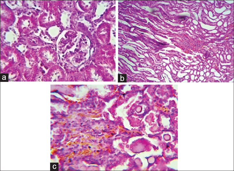 Irbesartan ameliorates renal histopathological changes during gentamicin-induced nephrotoxicity, (a) Histological picture shows normal looking renal tissue (Glomeruli and tubules, H and E, ×400(reflect the effect of normal saline, (b) Histological section show severe medullary congestion (Score 4), detected on power of magnification × 100, H and E, which reflect the effect of gentamicin, (c) Histological section show moderate medullary congestion (Score 2), detected on power of magnification × 200, H and E, which reflect the effect of irbesartan