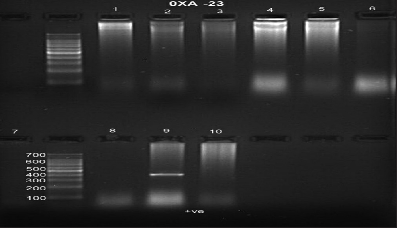 Polymerase chain reaction of OXA-23 was positive in 9 and the band was more than 453 bp