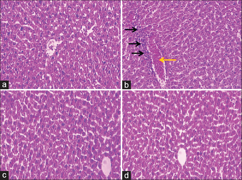 Microscopic images of liver tissue in mature rats in different groups (five-micron thick sections, H and E, ×100). Micrograph of the liver section in the control normal groups (a), normal liver structure. Micrograph of the liver section in malathion control group (b), increased white blood and macrophage cells (inflammation) (black arrows), and central hepatic vein dilatation and hyperemia (red arrow), due to the oxidative stress caused by malathion. Micrograph of the liver section in resveratrol (20 mg/kg) group (c), normal liver structure. Micrograph of liver section in resveratrol + malathion (20 mg/kg) group (d), normal liver structure