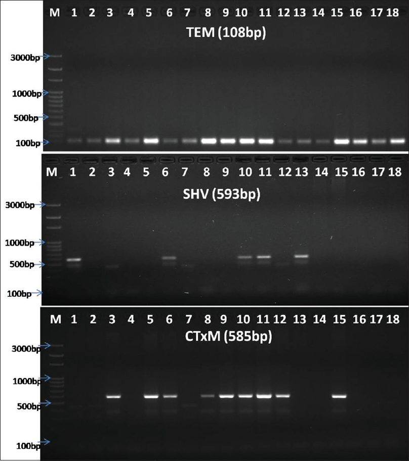 Banding pattern of TEM, SHV, and CTX-M genes through gel electrophoresis (Lane-M: 100 bp ladder, Himedia, India, and Lane-2–18: sample. TEM positive for samples 1–18; CTX-M positive for 1, 6, 10, 11, 13; SHV positive in samples 3, 5, 6, 8, 9, 10, 11, 12, 15)