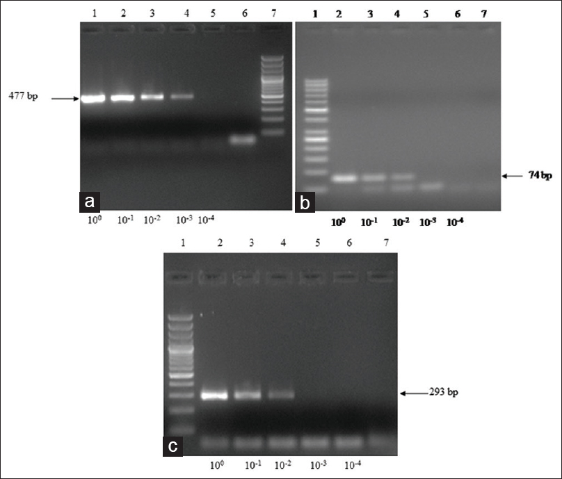 Sensitivity analysis of multiplex polymerase chain reaction on the DNA isolated from Entamoeba histolytica, Giardia lamblia, and Salmonella typhimurium. The DNA concentration was measured by spectrophotometer at 260 nm. (a) Amplification from serial four-fold dilution of Entamoeba histolytica DNA; Lane 1: 100; 2: 10-1; 3: 10-2; 4: 10-3; 5: 10-4; 6: Negative DNA; 7: DNA ladder-50 bp. (b) Amplification from serial four-fold dilution of Giardia lamblia DNA; Lane 1: DNA ladder-50 bp; 2: 100; 3: 10-1; 4: 10-2; 5: 10-3; 6: 10-4; 7: Negative control DNA. (c) Amplification from serial four-fold dilution of Salmonella typhimurium DNA; Lane 1: DNA ladder-50 bp; 2: 100; 3: 10-1; 4: 10-2; 5: 10-3; 6: 10-4 dilution; 7: Negative control DNA