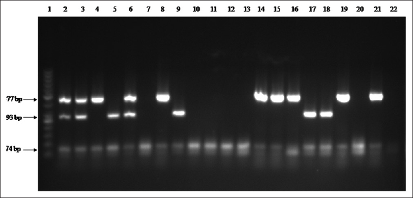 Multiplex polymerase chain reaction amplification of Entamoeba histolytica, Giardia lamblia and Salmonella spp. in collected water. Lane 1: DNA ladder-50 bp; Lane 2: Positive control (Entamoeba histolytica + Salmonella typhimurium + Giardia lamblia); Lane 3–21: Water samples; Lane 22: Negative control DNA