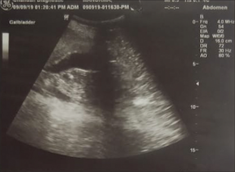 Ultrasound of the abdomen showing few solid, space-occupying lesions, and few cysts in the liver