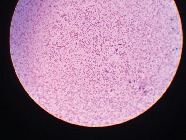 Gram staining picture of Brucella