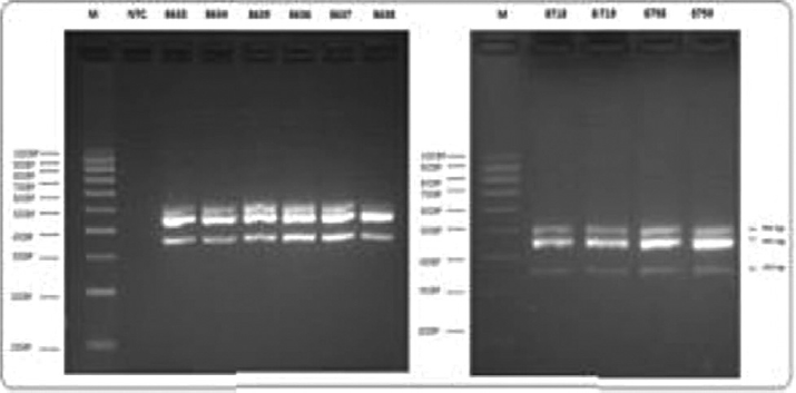 Detection of OXA-51-like, OXA-23-like genes and ISAba1 by multiplex PCR. A representative image of agarose gel electrophoresis showing detection of genes encoding OXA-carbapenemases and ISAba1. PCR, polymerase chain reaction.